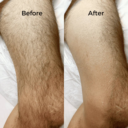 NUBIRA Pain-Free Hair Removal Cream