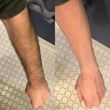 NUBIRA Pain-Free Hair Removal Cream