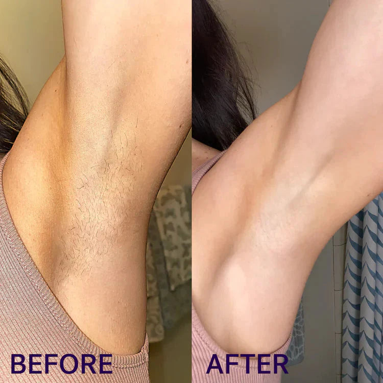NUBIRA Pain-Free Hair Removal Cream