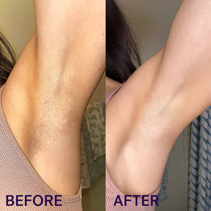 NUBIRA Pain-Free Hair Removal Cream